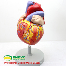 Exemple de commande pour BA Turquie - 2x Anatomical Heart Anatomical Model